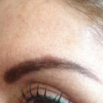 After – Wrinkle Treatments  to open eye area and reshape the brow  